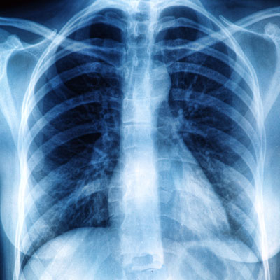 Chiropractic-Carpentersville-IL-X-Rays Chiropractic Carpentersville IL X-Rays